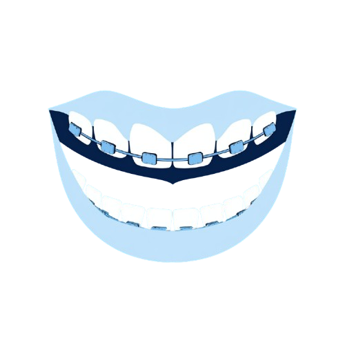 Orthodontic Treatment